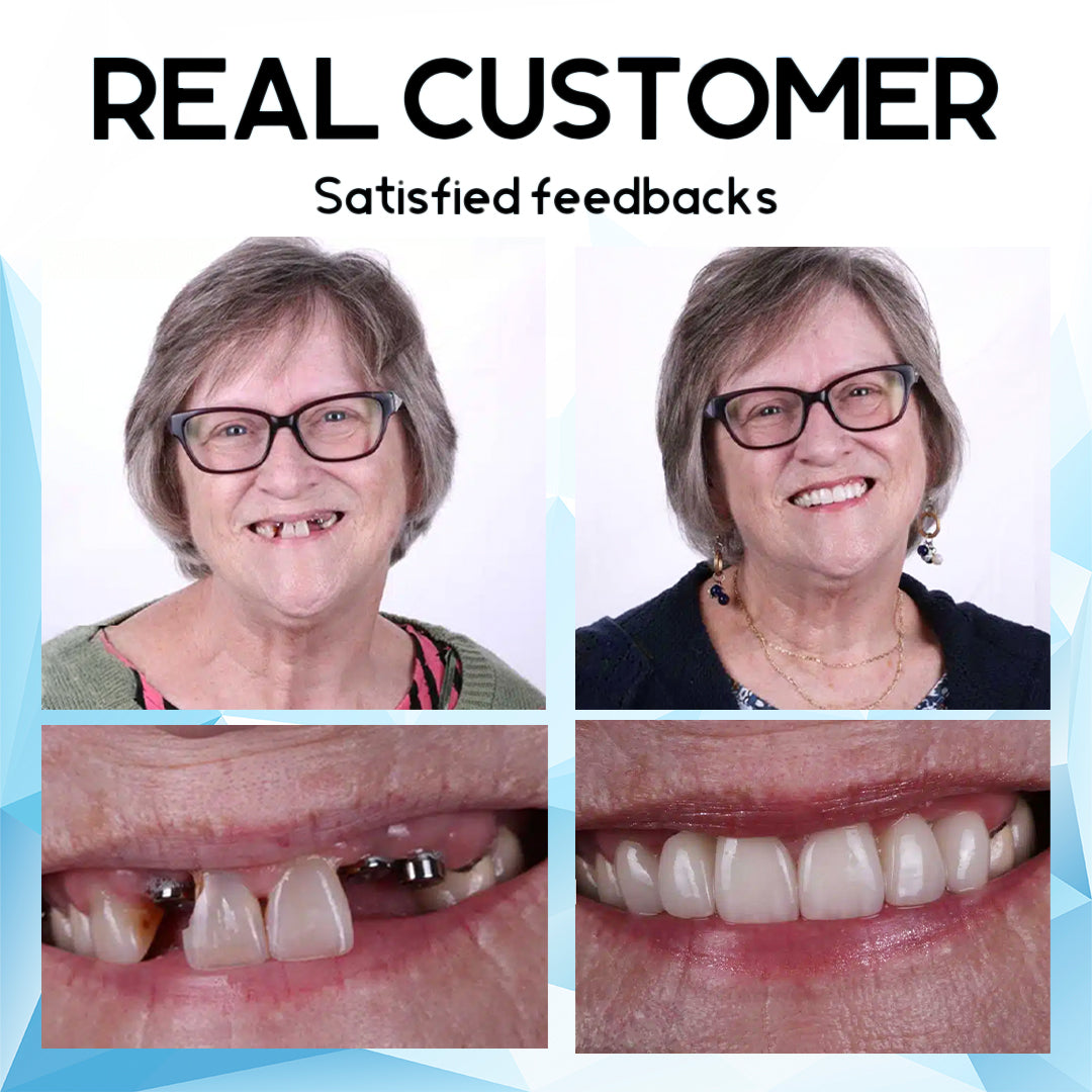 🇨🇦Furzero™ Silicone Reline Denture Set🦷