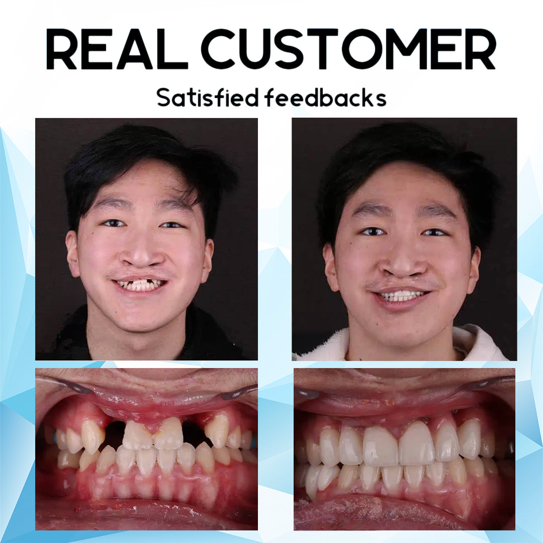 🇨🇦Furzero™ Silicone Reline Denture Set🦷