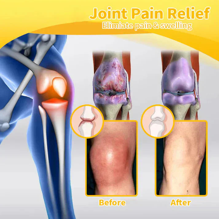☀️Aetheris™ Bee Venom Instant Ultra Strength Pain Relief Therapy Cream🇨🇦Health Canada Approved (Reducing joint swelling, pain, stiffness, redness, warmth, soreness and joint fatigue)