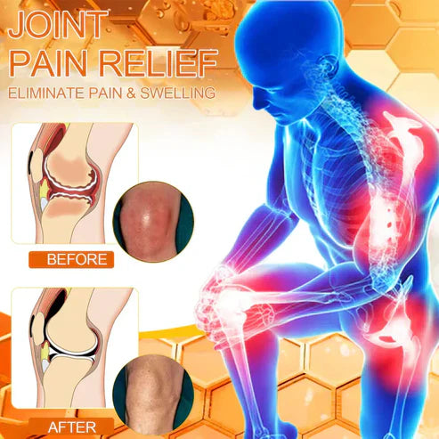 🎇Flysmus™ Bee Venom BPC-157 5mins Pain Relief Bone Healing Cream🇺🇸United States Pharmacopeia(USP)Approved (Reducing joint swelling, pain, stiffness, redness, warmth, soreness and joint fatigue)