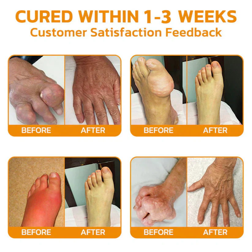 ☀️Aetheris™ Bee Venom Instant Ultra Strength Pain Relief Therapy Cream🇨🇦Health Canada Approved (Reducing joint swelling, pain, stiffness, redness, warmth, soreness and joint fatigue)