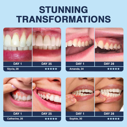Official Store❤️Furzero™ Focussmile Bee Venom Treatment Oral Powder 🦷 (🇺🇸 FDA-Certified) (Treats periodontitis and mouth ulcers, prevents loose tooth & bleeding gums, and repairs gum recession)